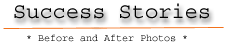 Click Here To See Before and After Photos of Success Stories